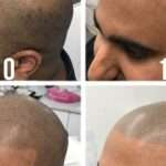 Comment repigmenter ses cheveux pour raviver leur couleur naturellement